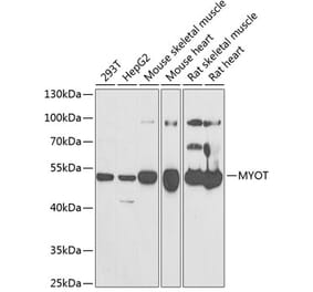 Western Blot - Anti-Myotilin Antibody (A9869) - Antibodies.com