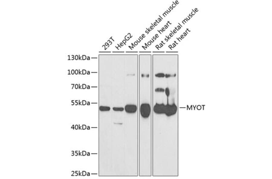 Western Blot - Anti-Myotilin Antibody (A9869) - Antibodies.com