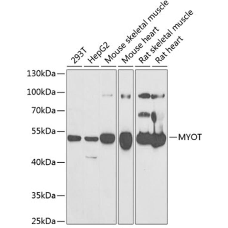 Western Blot - Anti-Myotilin Antibody (A9869) - Antibodies.com
