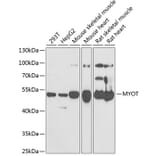 Western Blot - Anti-Myotilin Antibody (A9869) - Antibodies.com