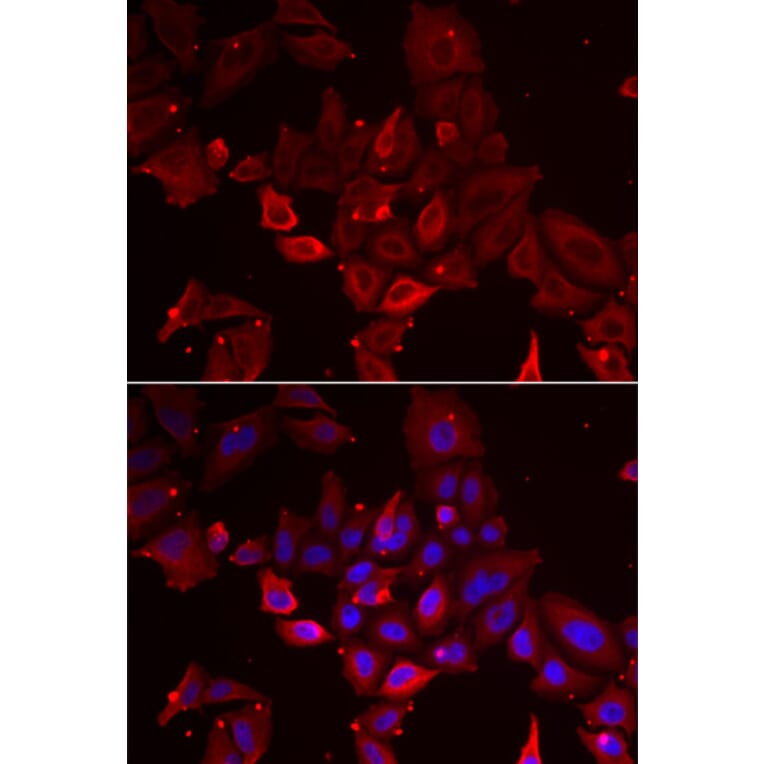 Immunofluorescence - Anti-Myotilin Antibody (A9869) - Antibodies.com