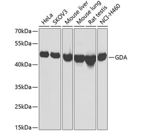 Western Blot - Anti-GDA Antibody (A9870) - Antibodies.com