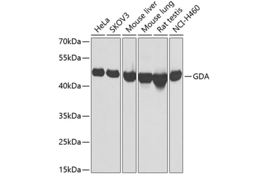 Western Blot - Anti-GDA Antibody (A9870) - Antibodies.com