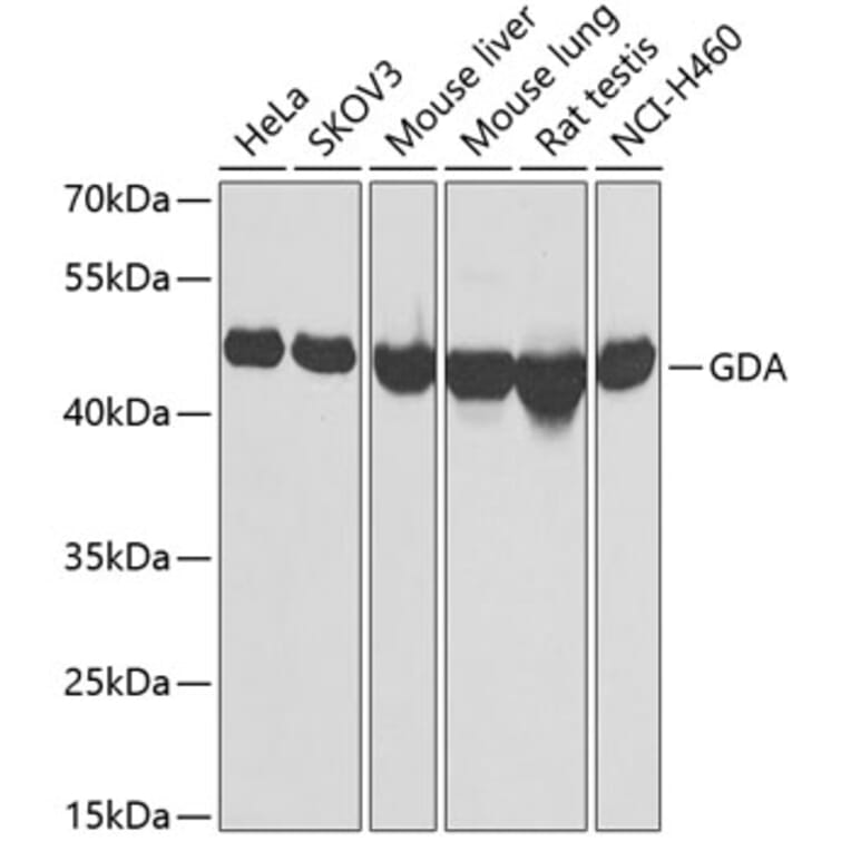 Western Blot - Anti-GDA Antibody (A9870) - Antibodies.com