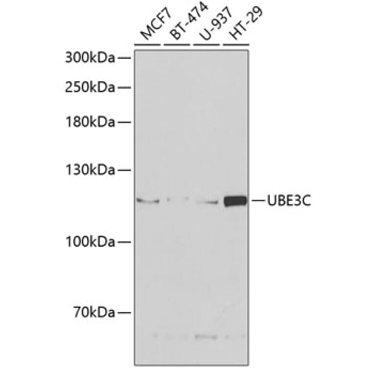 Western Blot - Anti-UBE3C Antibody (A6442) - Antibodies.com