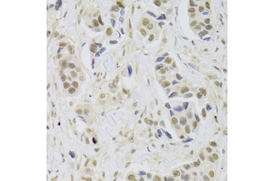 Immunohistochemistry - Anti-UBE3C Antibody (A6442) - Antibodies.com