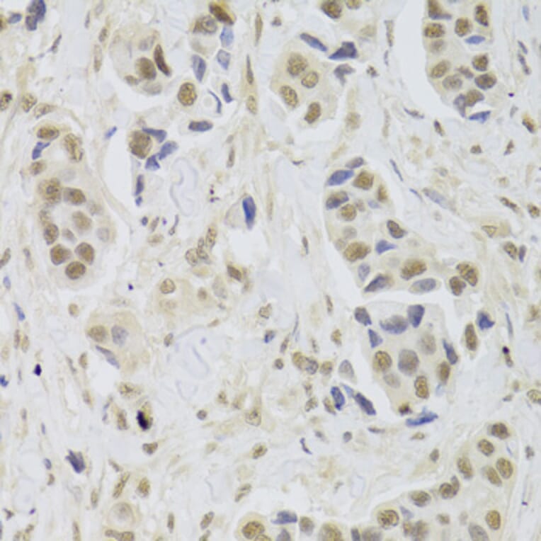 Immunohistochemistry - Anti-UBE3C Antibody (A6442) - Antibodies.com