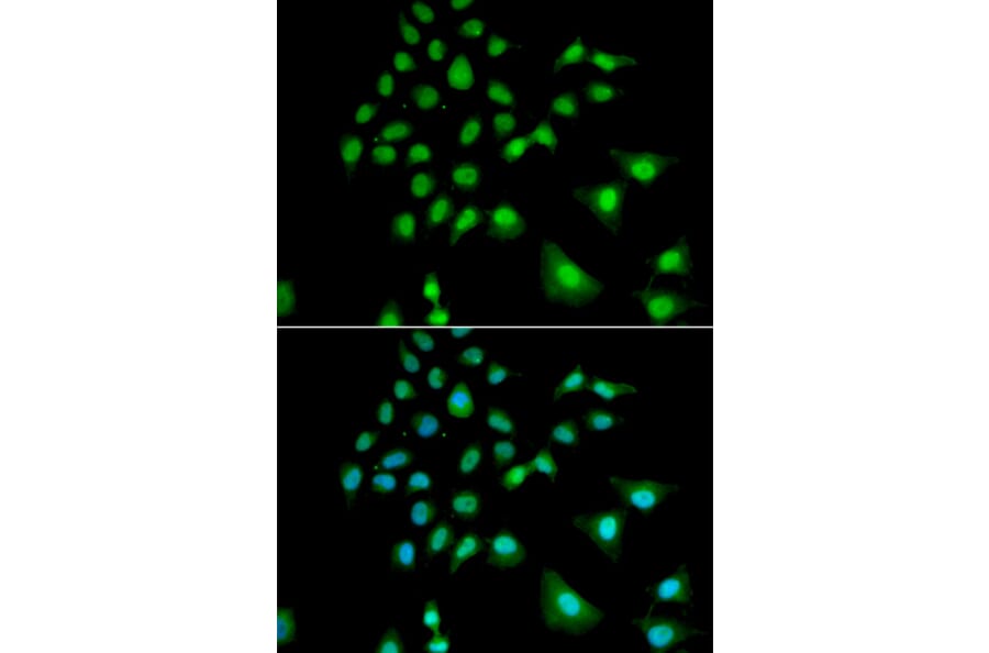 Immunofluorescence - Anti-UBE3C Antibody (A6442) - Antibodies.com