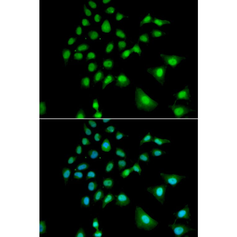 Immunofluorescence - Anti-UBE3C Antibody (A6442) - Antibodies.com