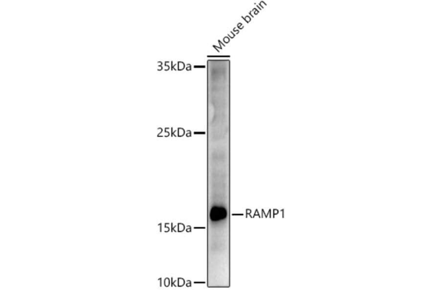 Western Blot - Anti-RAMP1 Antibody (A9872) - Antibodies.com