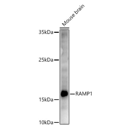Western Blot - Anti-RAMP1 Antibody (A9872) - Antibodies.com