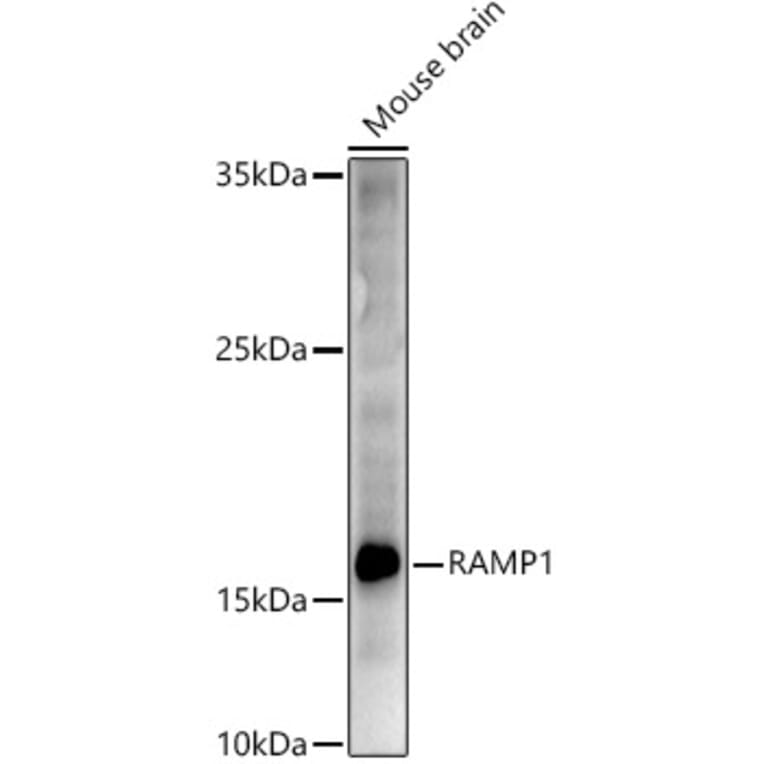 Western Blot - Anti-RAMP1 Antibody (A9872) - Antibodies.com