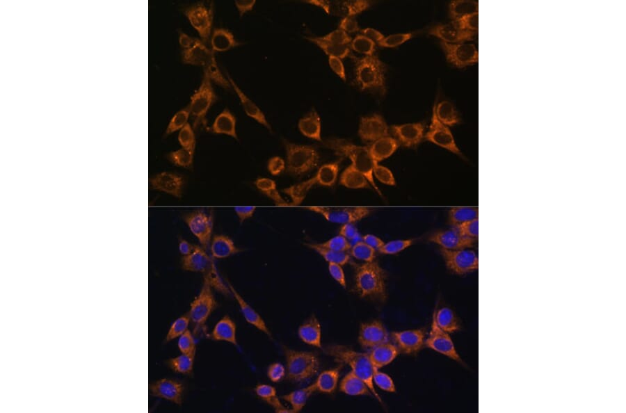 Immunofluorescence - Anti-RAMP1 Antibody (A9872) - Antibodies.com