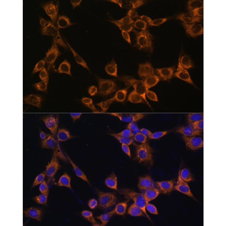 Immunofluorescence - Anti-RAMP1 Antibody (A9872) - Antibodies.com