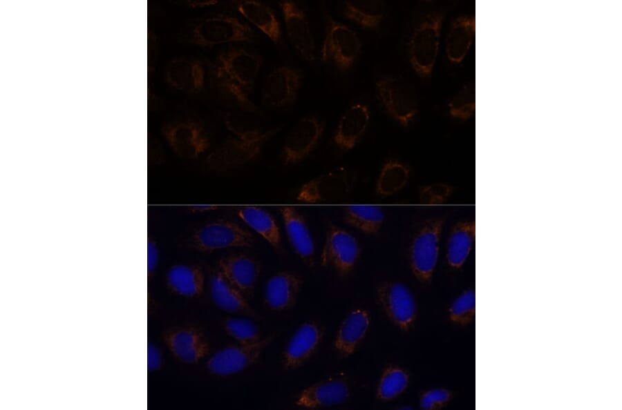 Immunofluorescence - Anti-RAMP1 Antibody (A9872) - Antibodies.com