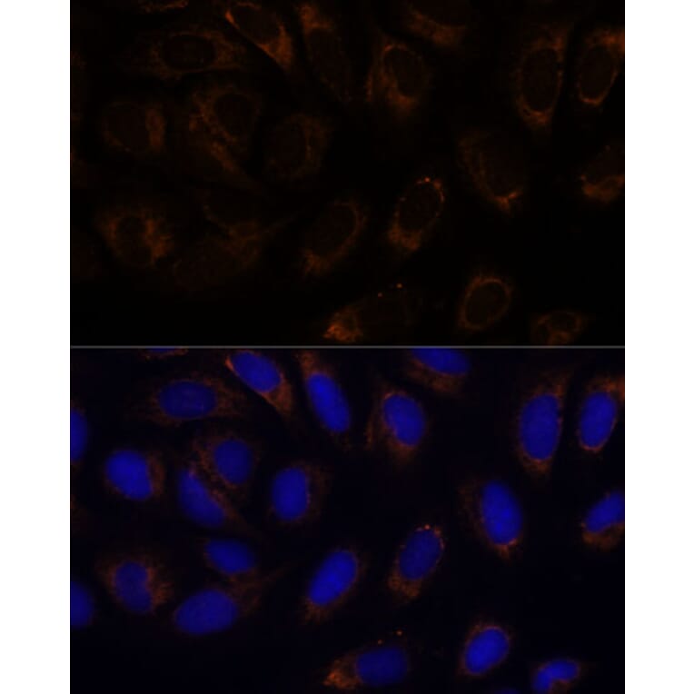 Immunofluorescence - Anti-RAMP1 Antibody (A9872) - Antibodies.com