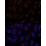 Immunofluorescence - Anti-RAMP1 Antibody (A9872) - Antibodies.com