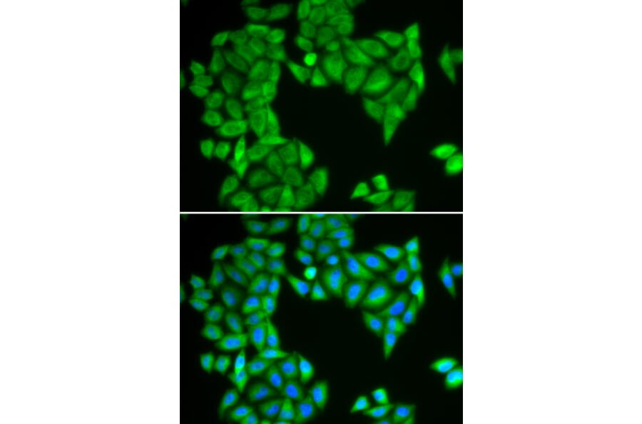 Immunofluorescence - Anti-SPAG5 Antibody (A6451) - Antibodies.com