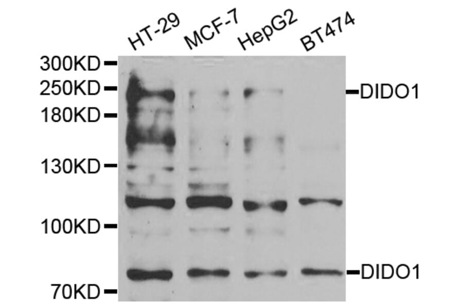 Western Blot - Anti-DIDO1 Antibody (A6453) - Antibodies.com