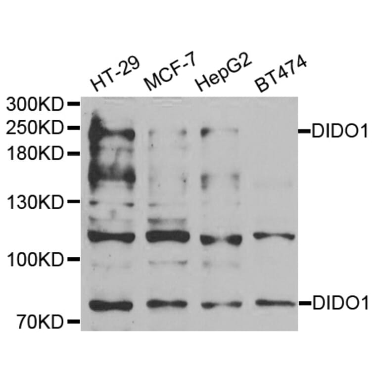 Western Blot - Anti-DIDO1 Antibody (A6453) - Antibodies.com