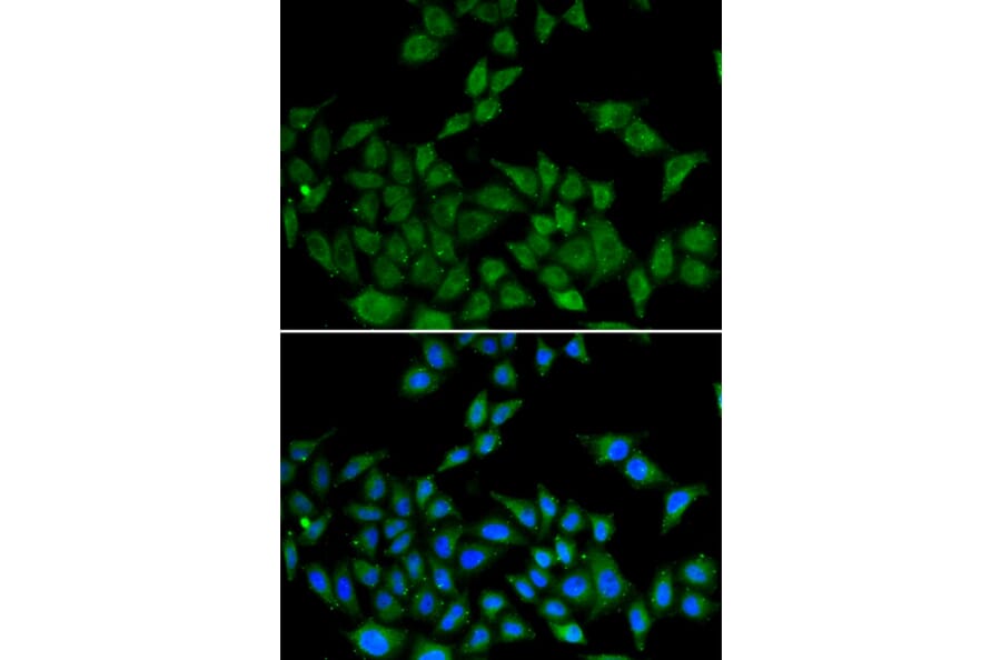 Immunofluorescence - Anti-DIDO1 Antibody (A6453) - Antibodies.com