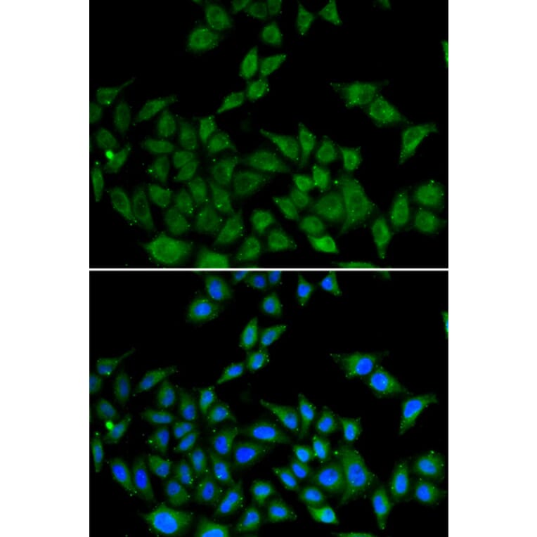 Immunofluorescence - Anti-DIDO1 Antibody (A6453) - Antibodies.com