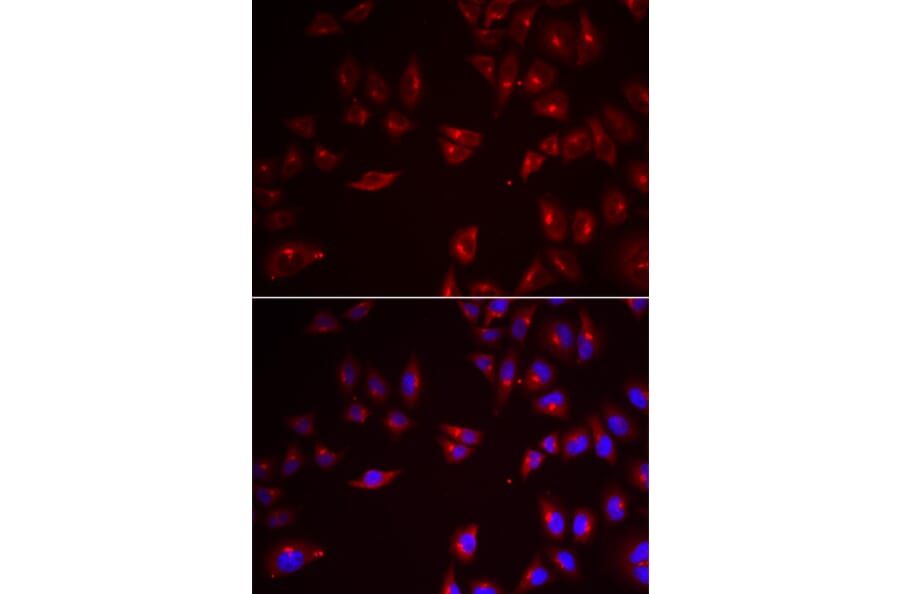 Immunofluorescence - Anti-PRAME Antibody (A6456) - Antibodies.com