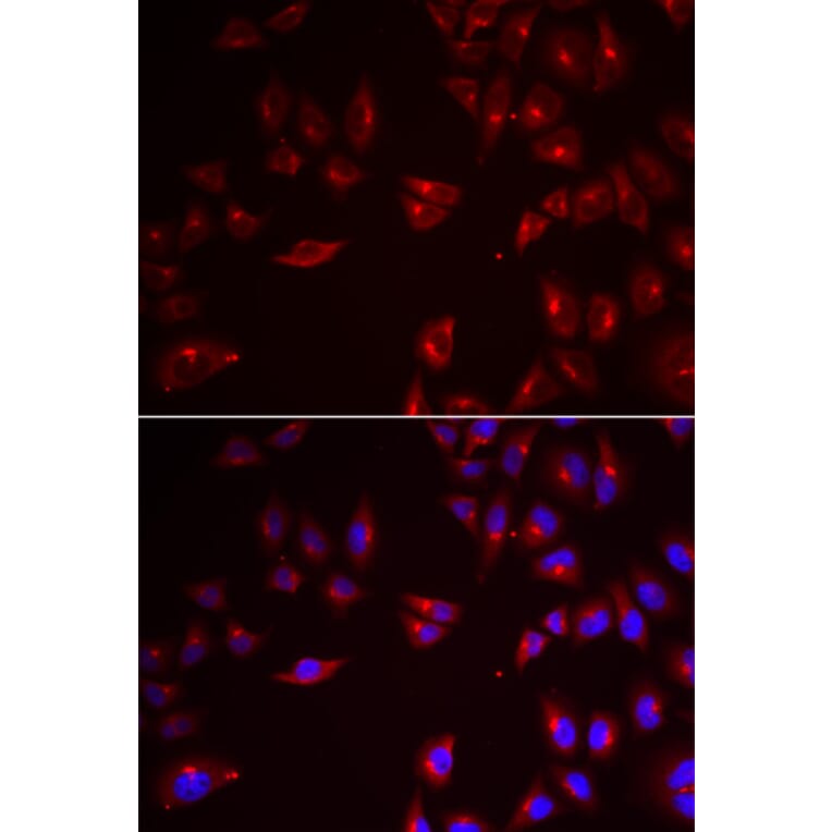 Immunofluorescence - Anti-PRAME Antibody (A6456) - Antibodies.com