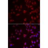 Immunofluorescence - Anti-PRAME Antibody (A6456) - Antibodies.com
