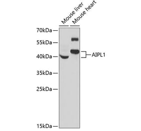 Western Blot - Anti-AIPL1 Antibody (A9876) - Antibodies.com