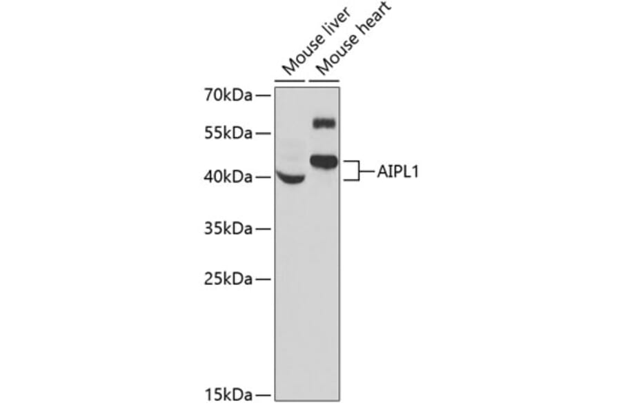 Western Blot - Anti-AIPL1 Antibody (A9876) - Antibodies.com