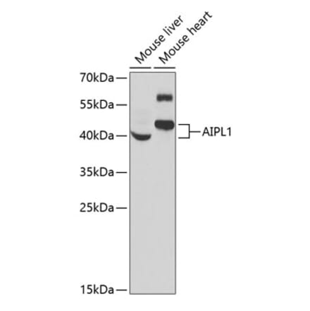 Western Blot - Anti-AIPL1 Antibody (A9876) - Antibodies.com