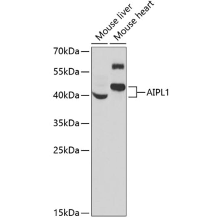 Western Blot - Anti-AIPL1 Antibody (A9876) - Antibodies.com