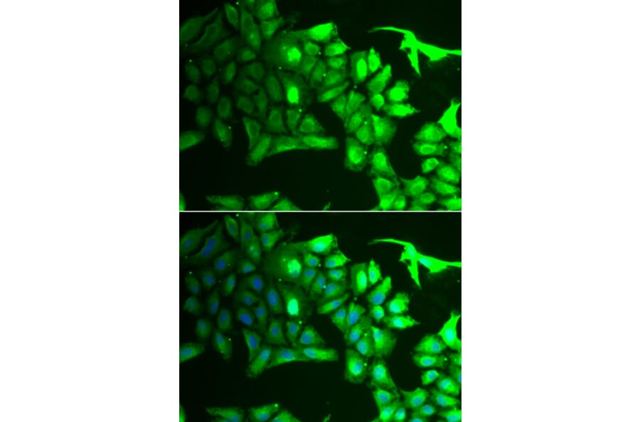 Immunofluorescence - Anti-AIPL1 Antibody (A9876) - Antibodies.com