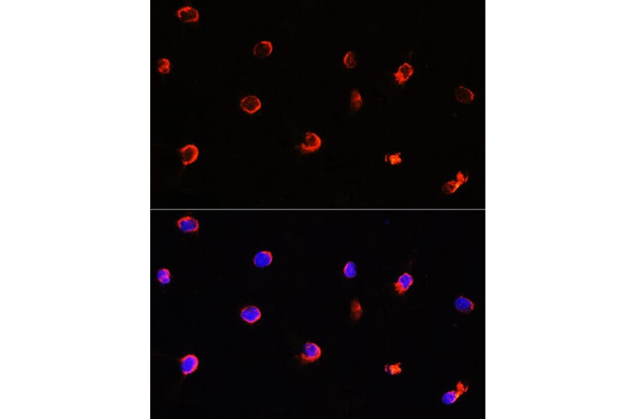Immunofluorescence - Anti-AIPL1 Antibody (A9876) - Antibodies.com