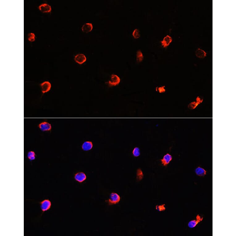Immunofluorescence - Anti-AIPL1 Antibody (A9876) - Antibodies.com