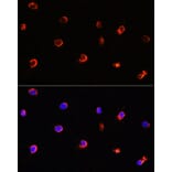 Immunofluorescence - Anti-AIPL1 Antibody (A9876) - Antibodies.com