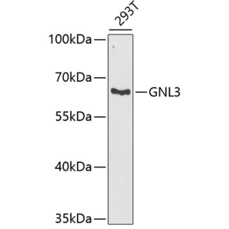 Western Blot - Anti-Nucleostemin Antibody (A9877) - Antibodies.com