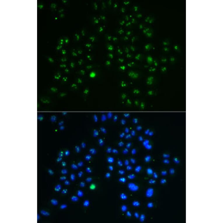 Immunofluorescence - Anti-Nucleostemin Antibody (A9877) - Antibodies.com