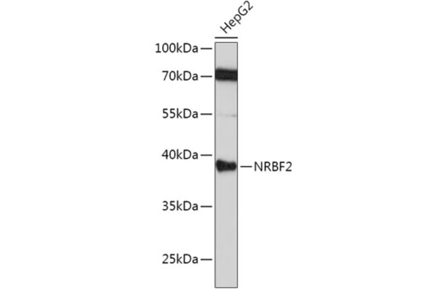 Western Blot - Anti-NRBF2 Antibody (A9878) - Antibodies.com