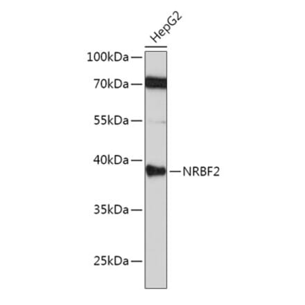 Western Blot - Anti-NRBF2 Antibody (A9878) - Antibodies.com