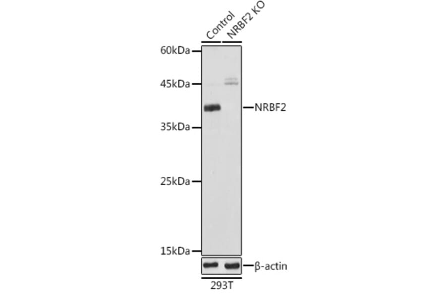 Western Blot - Anti-NRBF2 Antibody (A9878) - Antibodies.com