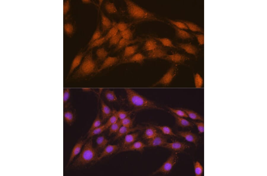 Immunofluorescence - Anti-NRBF2 Antibody (A9878) - Antibodies.com