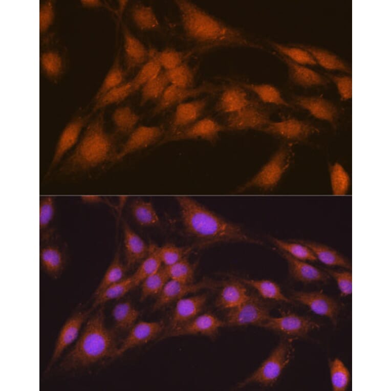 Immunofluorescence - Anti-NRBF2 Antibody (A9878) - Antibodies.com