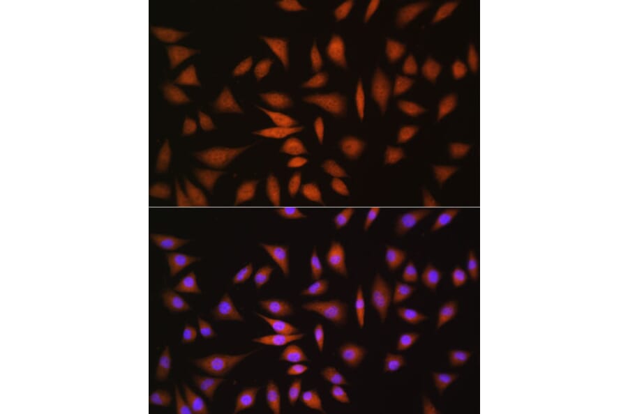 Immunofluorescence - Anti-NRBF2 Antibody (A9878) - Antibodies.com