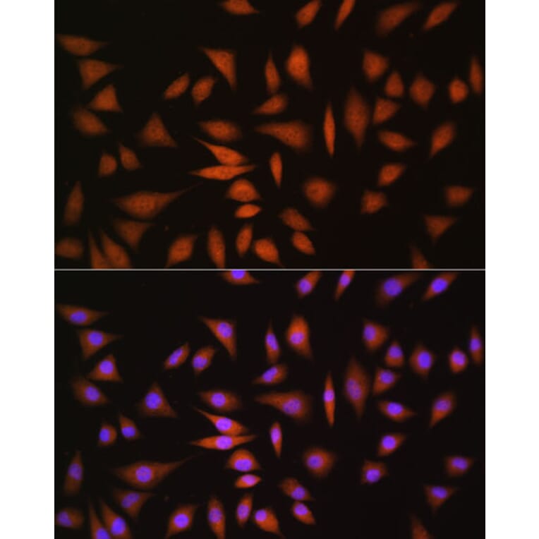 Immunofluorescence - Anti-NRBF2 Antibody (A9878) - Antibodies.com