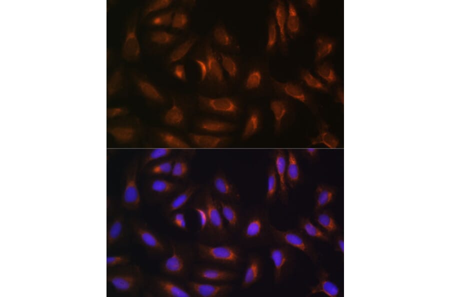 Immunofluorescence - Anti-NRBF2 Antibody (A9878) - Antibodies.com