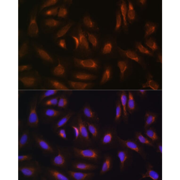 Immunofluorescence - Anti-NRBF2 Antibody (A9878) - Antibodies.com