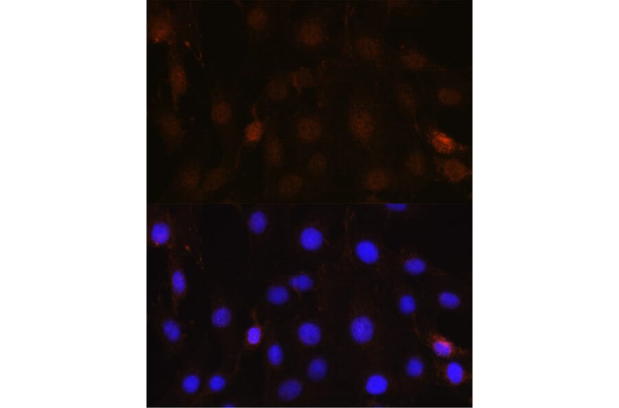 Immunofluorescence - Anti-NRBF2 Antibody (A9878) - Antibodies.com
