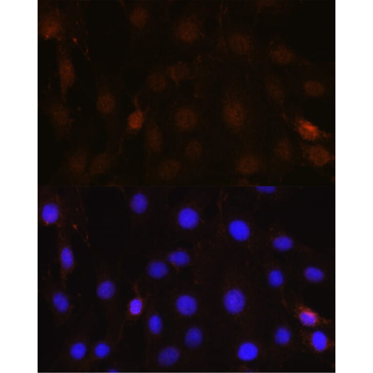 Immunofluorescence - Anti-NRBF2 Antibody (A9878) - Antibodies.com